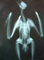 Radiografía tras la cirugía. 