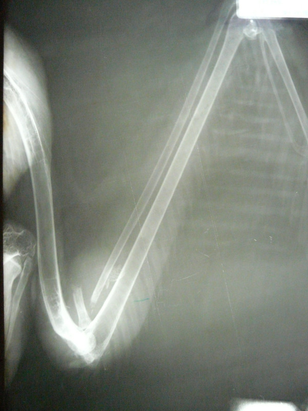 Radiografía del ala fracturada buitre negro (Aegypius mmonachus)
