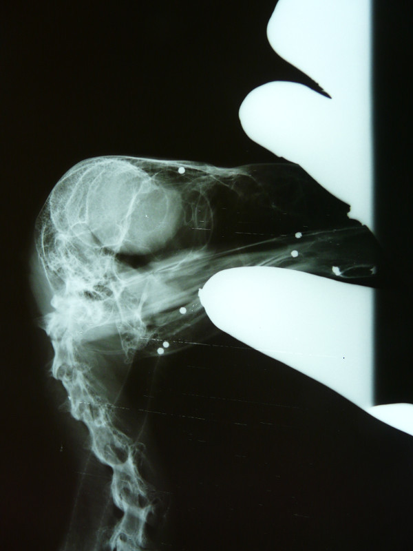 06 radiografía de la cabeza del buitre negro (Aegypius monachus)