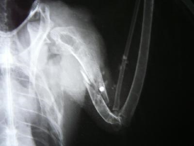 Radiografías del halcón tiroteado en las que se aprecia un perdigón alojado junto al húmero izquierdo (foto: GREFA)