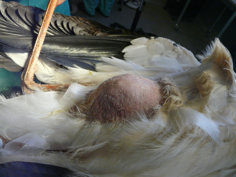 Abdomen de la cigüeña antes de la cirugía