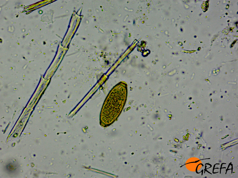 Huevo de nematodo encontrada en las heces vista al microscopio.