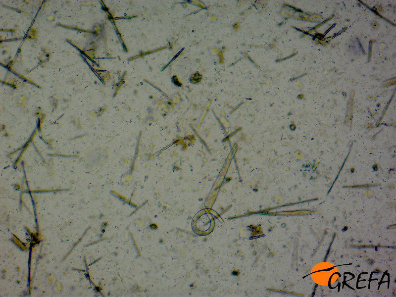 Larva de nematodo visto al al microscopio.