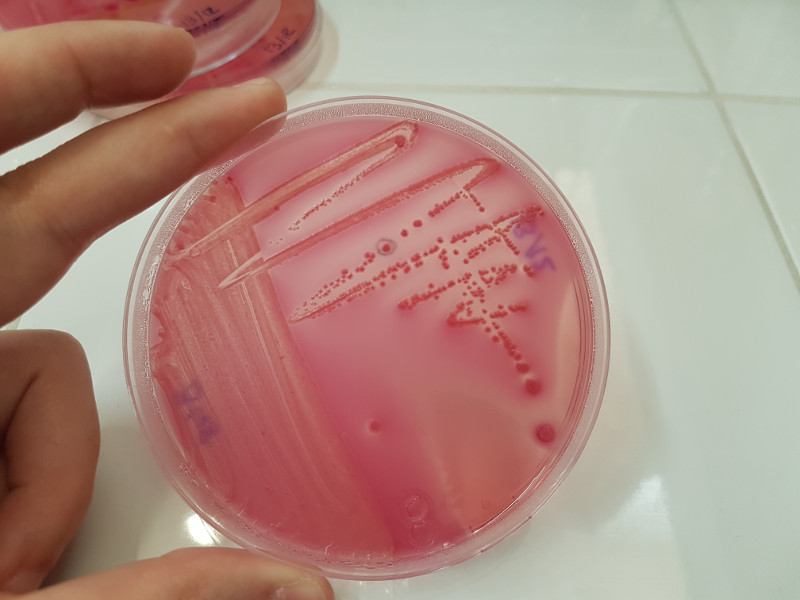 Aislamiento en laboratorio de Escherichia coli, causante de colibacilosis.
