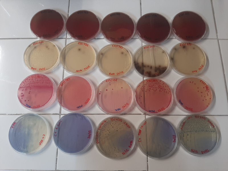 Cepas pertenecientes al proyecto WILDBIOPHAGE en diferentes medios de cultivo selectivos.